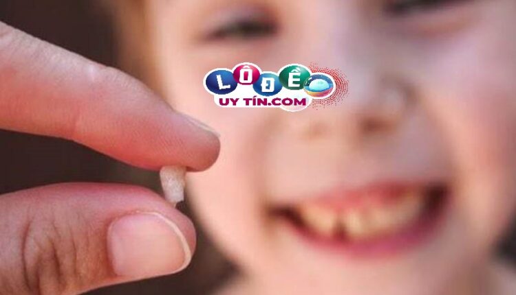 Mơ gãy răng là điềm tốt hay xấu, đánh con gì? 3 Mơ gãy răng là điềm tốt hay xấu, đánh con gì 1