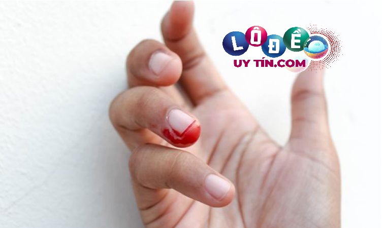 Mơ thấy máu là điềm gì, đánh con gì? 2 Mơ thấy máu là điềm gì, đánh con gì