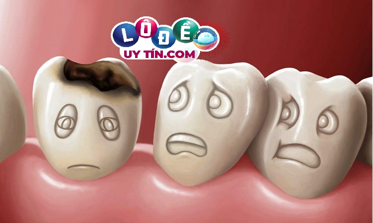 Nằm mơ thấy bị mẻ răng là điềm gì? Đánh số nào? 3 Nằm mơ thấy bị mẻ răng là điềm gì? Đánh số nào 2