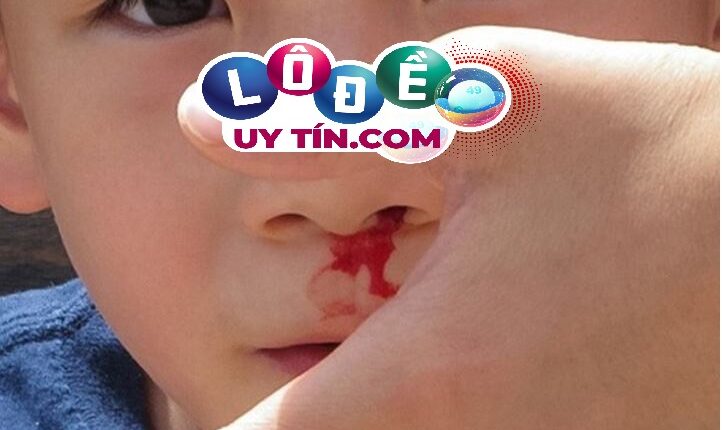 mơ thấy chảy máu mũi